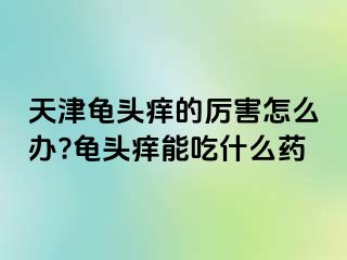 天津龟头痒的厉害怎么办?龟头痒能吃什么药