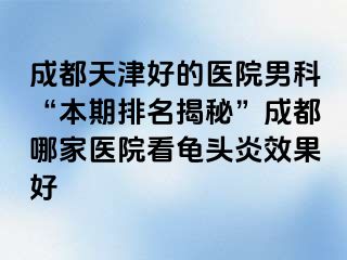 成都天津好的医院男科“本期排名揭秘”成都哪家医院看龟头炎效果好